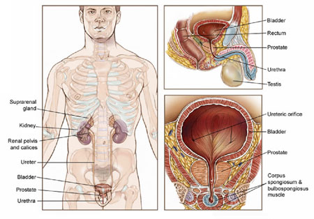 prostate cancer treatment chennai