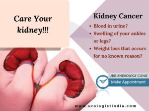 Kidney cancer treatment Chennai